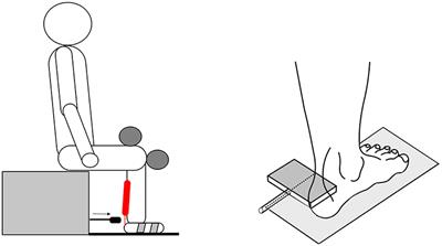 Repetitive Peripheral Magnetic Nerve Stimulation (rPMS) as Adjuvant Therapy Reduces Skeletal Muscle Reflex Activity